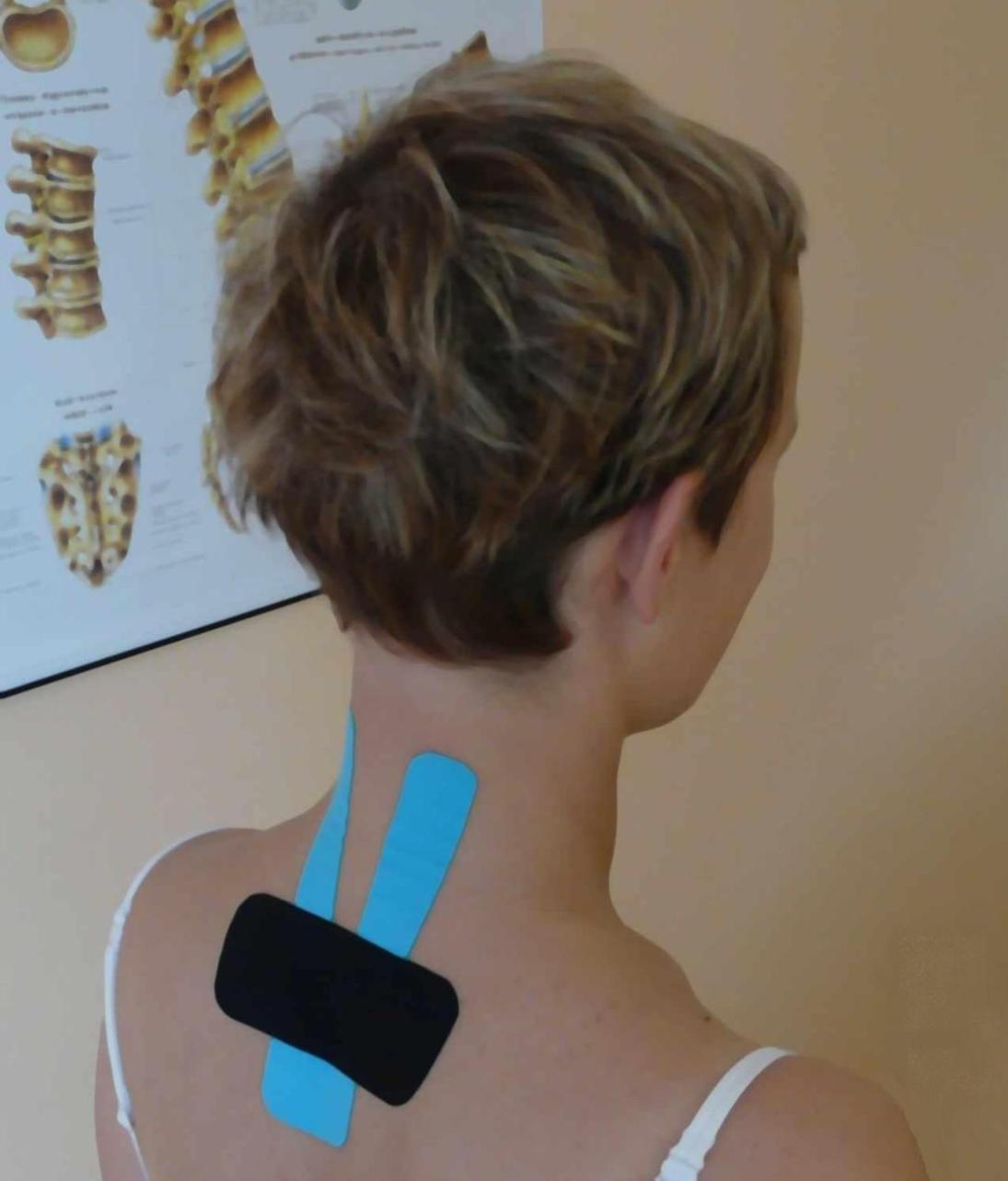 kinesiology taping